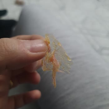 Damla Şekerde Yabancı Cisim Bulunması Hijyen Ve Sağlık Endişesi