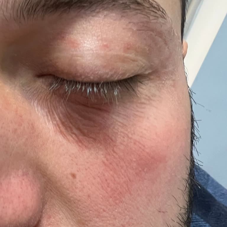 İlaçların Etkisizliği Ve Takip Eksikliği Nedeniyle Hayal Kırıklığı