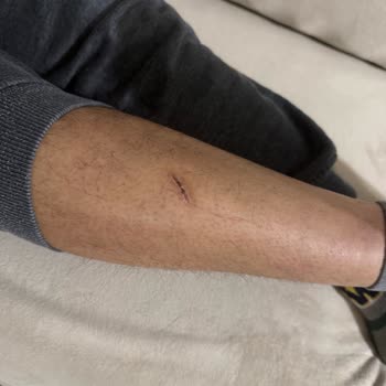 Keskin Kenarlı Çocuk Yatağının İadesi Ve Güvenli Değişim Talebi