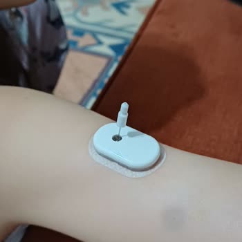 Kola Değişiminde İğnenin Dışarıda Kalması Güvenlik Sorunu Ve Değişim Talebi