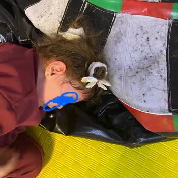 Balondan Yapışan Saçlar, Gecikmiş Bildirim Ve Tek Personelle Yetersiz Gözetim