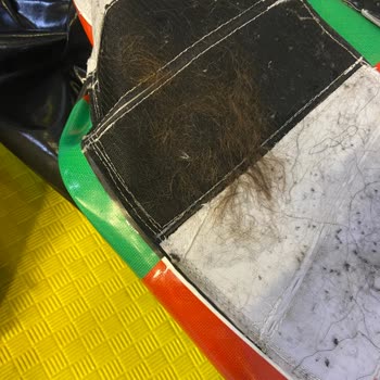 Balondan Yapışan Saçlar, Gecikmiş Bildirim Ve Tek Personelle Yetersiz Gözetim