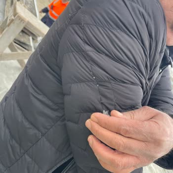 Kaz Tüyü Dökülmesi Nedeniyle Mont İadesi Ve Ücret İadesi Talebi