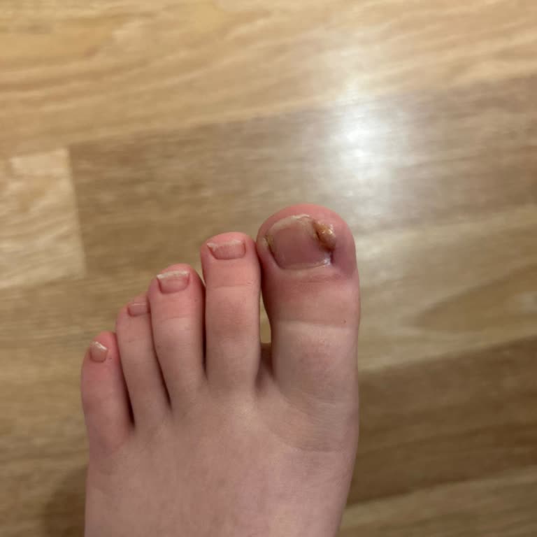 9 Bin TL'lik Ayak Tedavisinde Yanıltıcı Sözler Ve Çözüm Yok