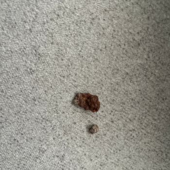 Nestle Nesfit Çikolatalı Mısır Gevreğinde Beyaz Küf Ve Sağlık Riski