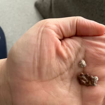 Nestle Nesfit Çikolatalı Mısır Gevreğinde Beyaz Küf Ve Sağlık Riski