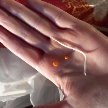 Lezzet-i Efsane Basmati Pirincinde Mercimek Ve Plastik Parçası Bulundu, Acil İnceleme Gerekiyor