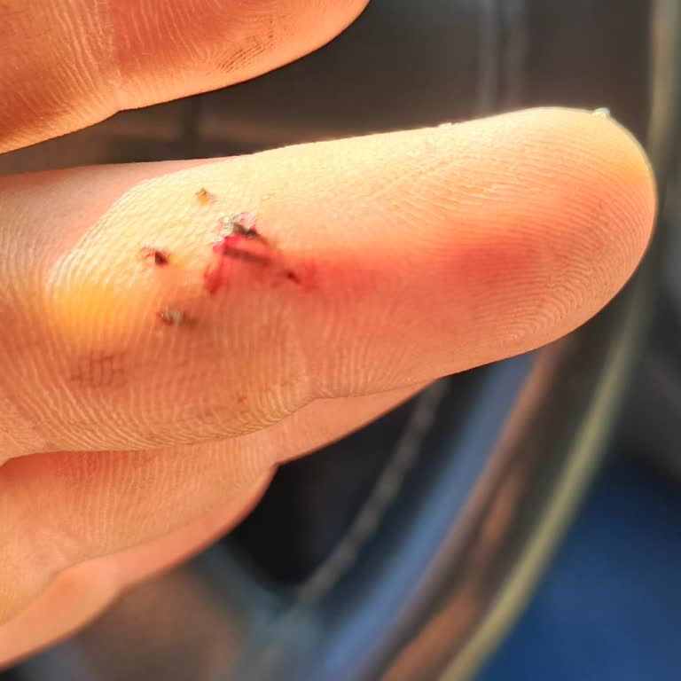 Uğur Derin Dondurucu Amblemindeki Keskin Metal Parçalar Ciddi Yaralanmaya Neden Oldu