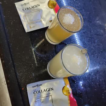 Kolajen Day2Day Şasi Tuhaf Çıktı!