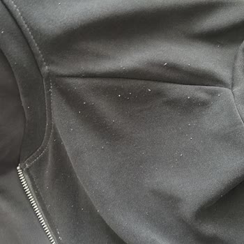 İade Reddedildi, Deforme Ürünle Mağduriyet Ve Kargo Masrafları