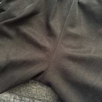 Kısa Sürede Tüylenen Eşofman Ve Mağazanın Kullanıcı Hatası İddiası