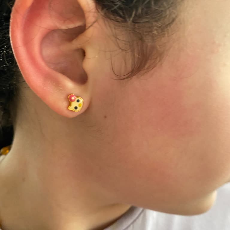 Sebamed Şampuanı Çocuğumda Şiddetli Kızarıklık Ve Kaşıntıya Neden Oldu