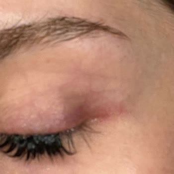 Luxe Aura Beauty Studio Hem İşlem Sırasında Hem Sonrasında Ciddi Acı Ve Rahatsızlık Yaşadım