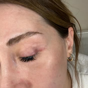 Luxe Aura Beauty Studio Hem İşlem Sırasında Hem Sonrasında Ciddi Acı Ve Rahatsızlık Yaşadım