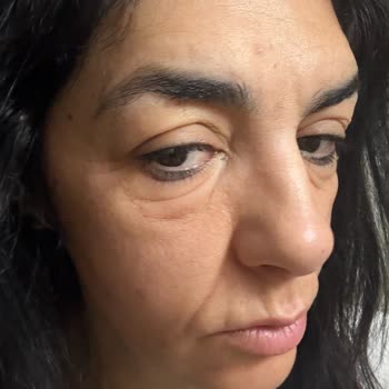 Alerjik Reaksiyon Yaratan Clarins Maskara Satışı Ve İade Sorunu