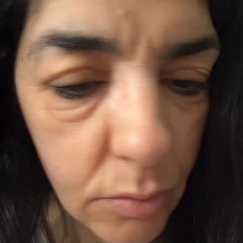 Alerjik Reaksiyon Yaratan Clarins Maskara Satışı Ve İade Sorunu