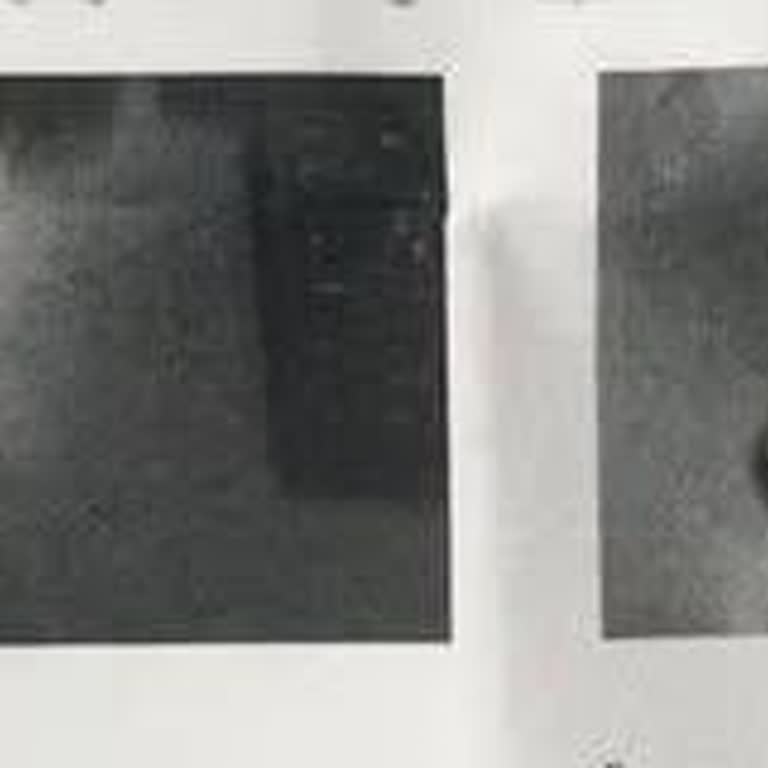 Sigorta Kapsamındaki Onarım Gecikmesi Ve Düşük Değerli Teklif