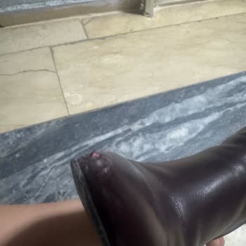 Derimod Botta Deri Hemen Yıprandı Ve Müşteri Hizmetleri Red Cevabı Verdi