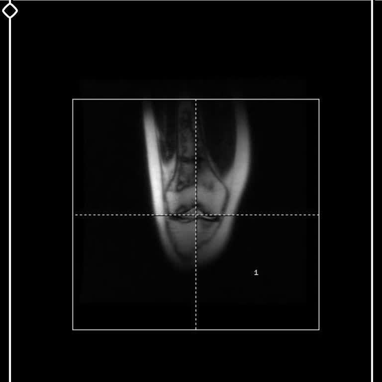 MR Raporu E-Nabız’da Görünmüyor, Acil Yükleme Gerekiyor
