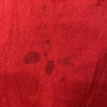 Arçelik Çamaşır Makinesinde Üç Yıllık Temizlenmeme Ve Koku Sorunu, Servis Çözüm Sunamıyor