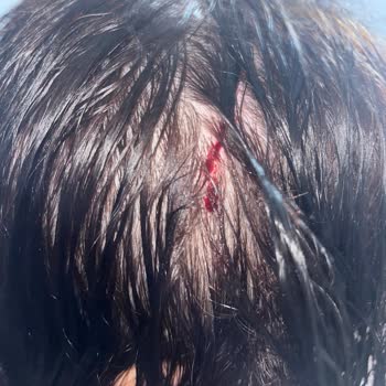 Bursa Orhangazi Şubesinde Erzak Dolabının Devrilmesi Sonrası Ciddi Yaralanma Ve Maddi Zarar Talebi