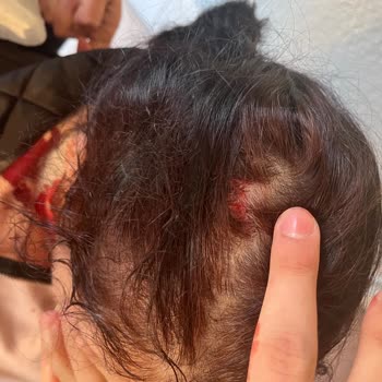 Bursa Orhangazi Şubesinde Erzak Dolabının Devrilmesi Sonrası Ciddi Yaralanma Ve Maddi Zarar Talebi