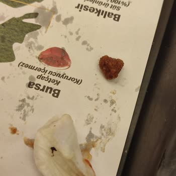 McDonald's Şubesinde Yemek İçinden Siyah Yabancı Cisim Çıktı, Müdür Sorgulayıcı Davranış Sergiledi