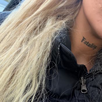 Saç Kaynakları Kesildi Ve 14.000 TL'lik Ödeme Sonrası Ağır Yıpranma