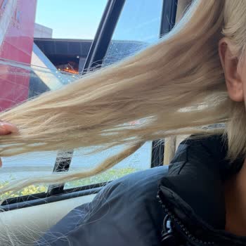 Saç Kaynakları Kesildi Ve 14.000 TL'lik Ödeme Sonrası Ağır Yıpranma