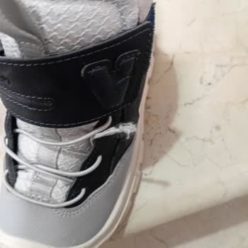 Vicco Botunun İlk Gün Kırılması Ve Hızlı Değişim Talebi