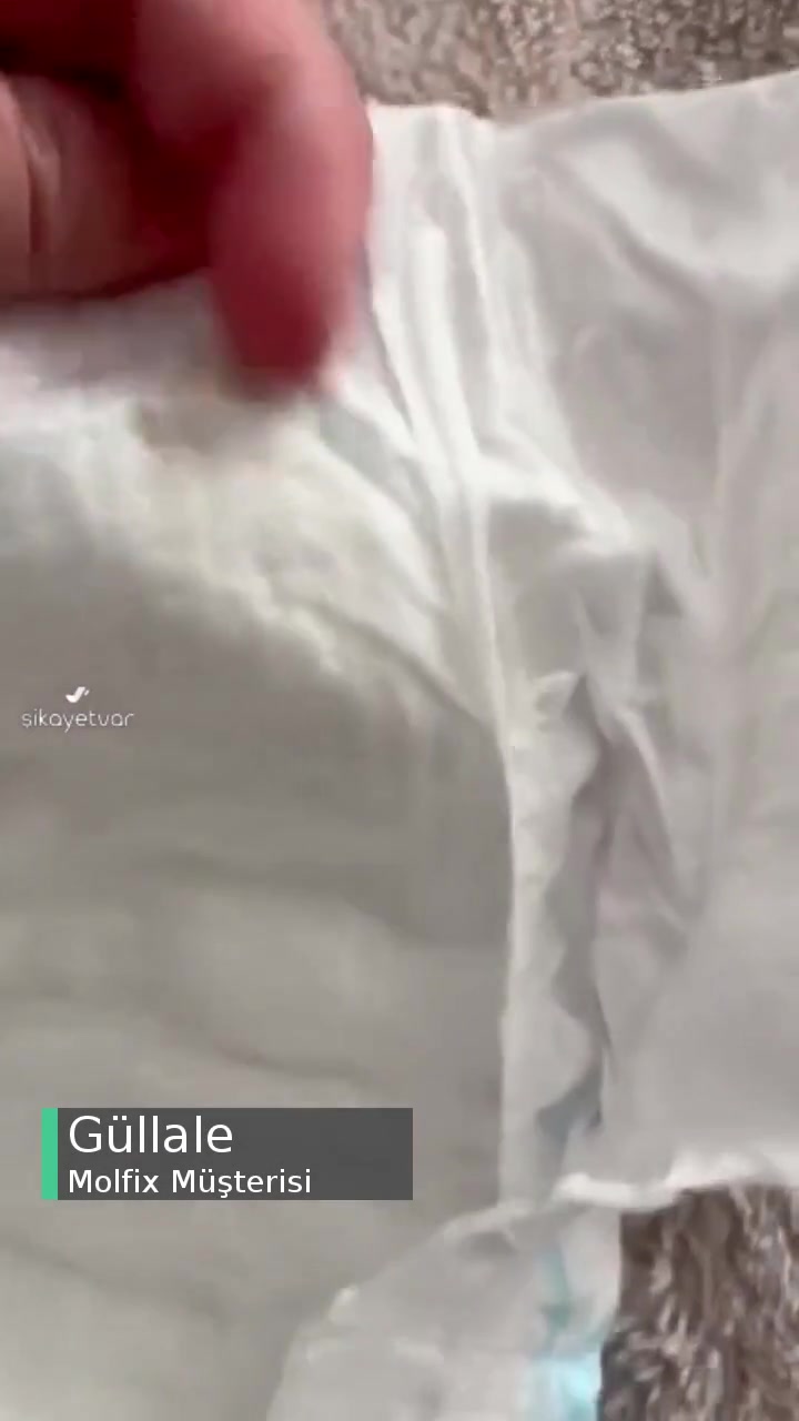 Molfix Bebek Bezi İçerisinde Çıkan Cisim videonun kapak resmi