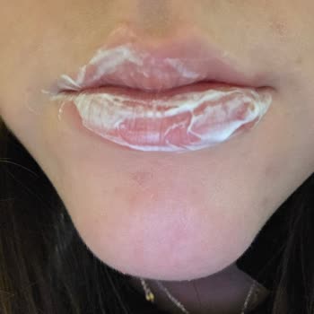 Maybelline Rujunda Alerjik Reaksiyon Ve Şiddetli Ağız Ağrısı