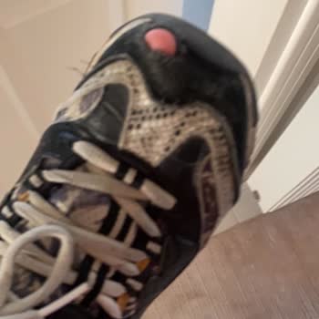 Skechers D’Lites Modelinde Tek Noktadan Hızlı Yırtılma ve Güven Kaybı