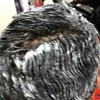 Silinmiş Son Kullanma Tarihi Ve Bozuk Saç Düzleştirme Kremi Cilt Tahrişine Yol Açtı