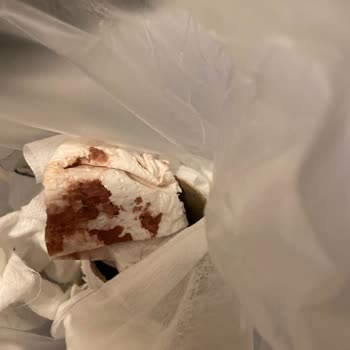 Kabanın Cebinde Kanlı Peçete Hijyen Skandalı Ve Şikayetime Cevap Gelmedi