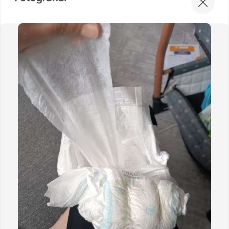 Molfix Bebek Bezinde İç Tabakanın Kendi Kendine Sökülmesi ve İade Talebi