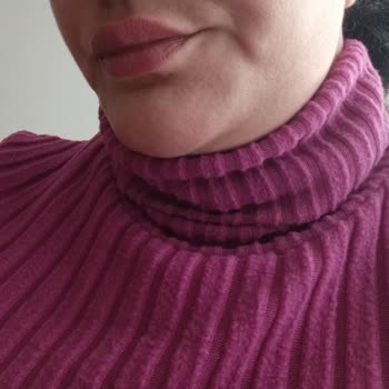 Elazığ Özel Medilines Hastanesi Plastik Ve Estetik Cerrahi Beklediğim Estetik Sonuç Oluşmadı