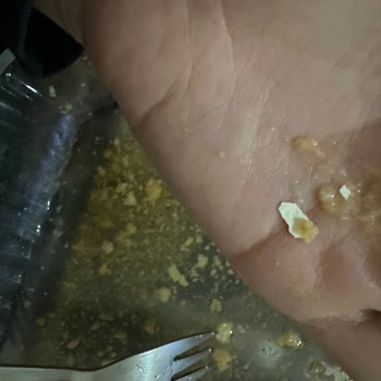 Tatseli - Nevzat Tatlıcılık Hamurun İçinden Parça Halinde Yumurta Kabuğu Çıktığı