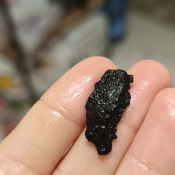 Koska Nazar Boncuklu Sağlığımı Riske Atan Bir Durum