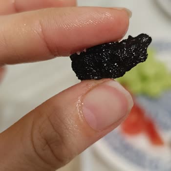 Koska Nazar Boncuklu Sağlığımı Riske Atan Bir Durum