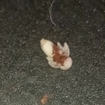 Kocatepe Kahve Evi Türk Kahvemden Böcek Çıktı