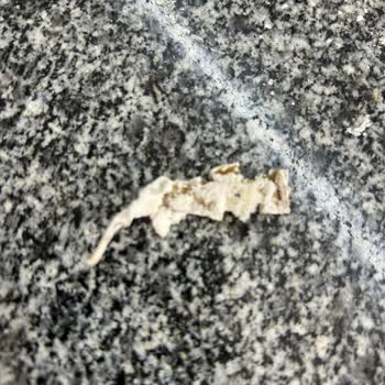 Un Paketi İçinde Yabancı Cisim, Sağlık Ve Maddi Mağduriyet