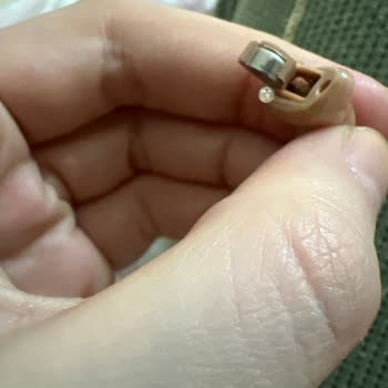 Sık Arıza Ve Uzun Servis Beklemesi Nedeniyle Oticon İşitme Cihazı Değişim Talebi