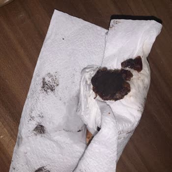 Hurmadaki Şüpheli Siyah Madde Ve BİM’in Cevapsız Tutumu