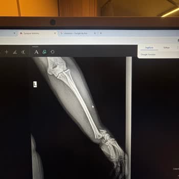 Medical Park Gebze Hastanesinde Acil Müdahale Eksikliği Ve Aşırı Ameliyat Ücreti Talebi