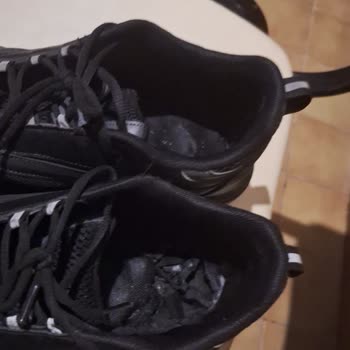 Ayakkabının İç Tabanı Deforme Oldu, Önü Açıldı; Trendyol’un Uzayan İade Süreci