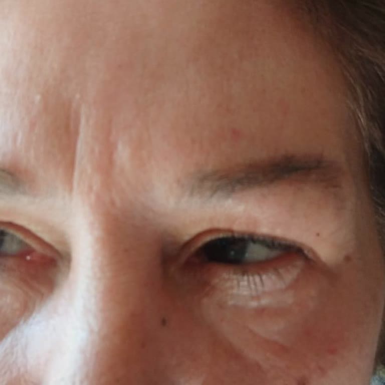 London Dr Clinics 3 Aydır Bugün Yarın Denilerek İade Yapılmadı