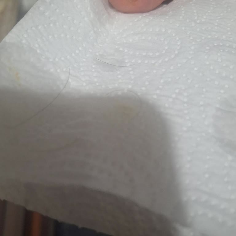 Sinangil Ununda Kıl Ve Saç Teli Sorunu