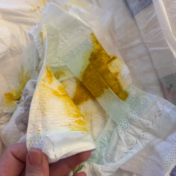 Pampers Bezinde Sürekli Sızma Ve Hijyen Sorunu