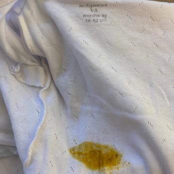 Pampers Bezinde Sürekli Sızma Ve Hijyen Sorunu